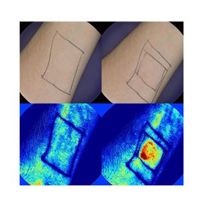 Skin Sensitisation Testing