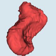 Scaphoid bone, 3D model, CT data, 3d bioprinting